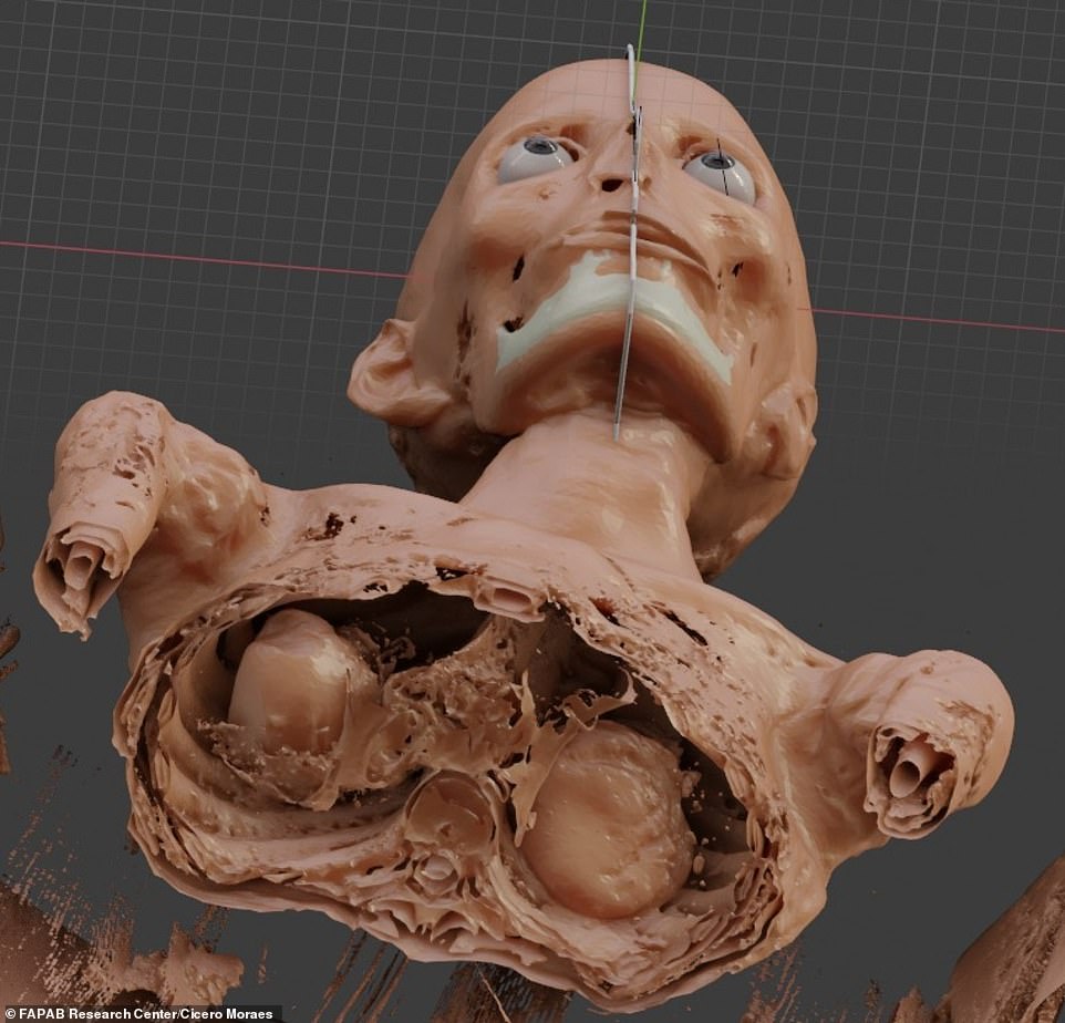 Reconstructed tissue looking up towards per thoracic cavity