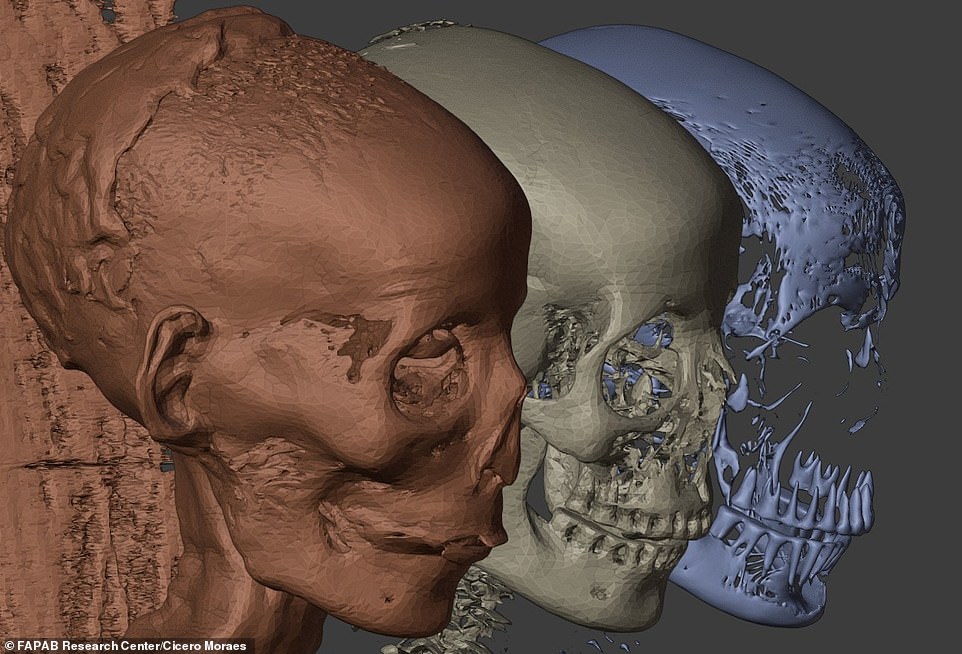 Mentioned in the first reports from 1820 is the good and complete preservation of the teeth. The harmonious and well-proportioned skull suggests that Schepenese was probably a beautiful lady during her lifetime