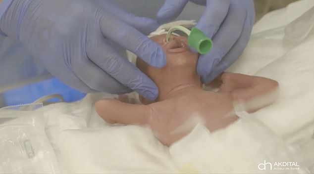 A 25-year-old gave birth to nonuplets in May